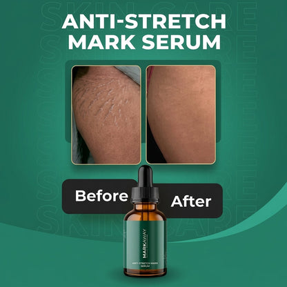 Markaway Stretch Serum